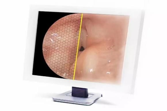 Medical instrument endoscope training (1)